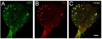 Functional and Molecular Analysis of Proprioceptive Sensory Neuron Excitability in Mice